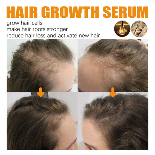 Biotin Hair Growth & Repair Spray