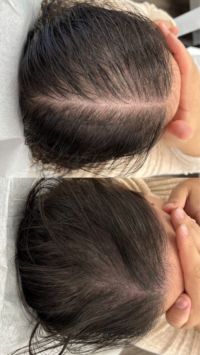 Hair Growth & Repair Spray
