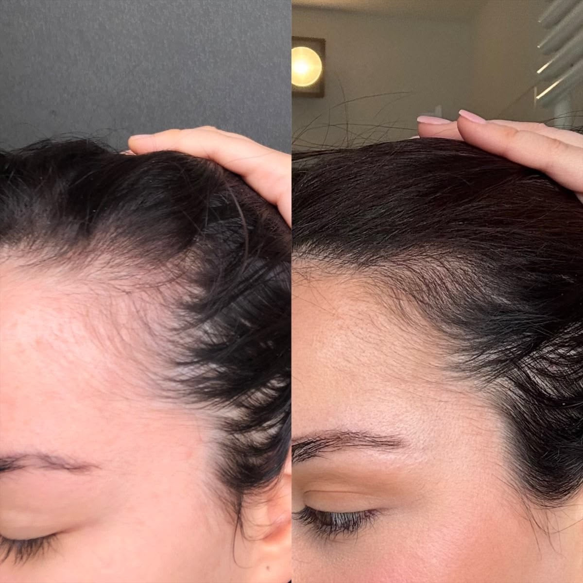 Biotin Hair Growth & Repair Spray